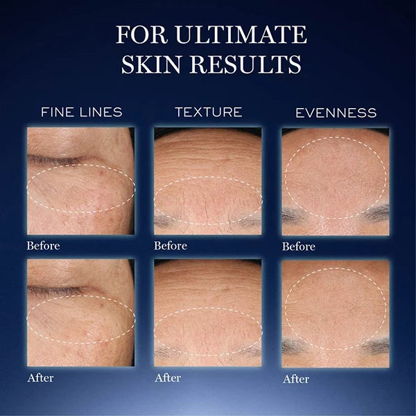 Lancome Genifique Ultimate Serum